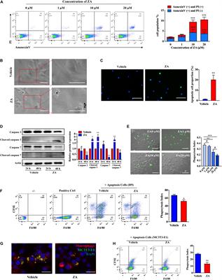 Geranylgeraniol Restores Zoledronic Acid-Induced Efferocytosis Inhibition in Bisphosphonate-Related Osteonecrosis of the Jaw